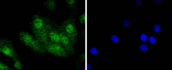 Aurora A Recombinant Rabbit Monoclonal Antibody