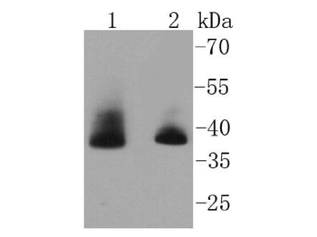 Aurora B Recombinant Rabbit Monoclonal Antibody