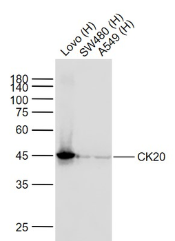 CK20 Recombinant Rabbit Monoclonal Antibody