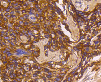 Cytokeratin 16 Recombinant Rabbit Monoclonal Antibody
