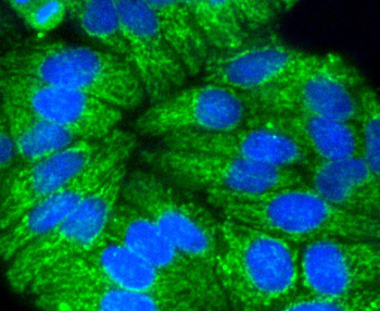 Cytokeratin 17 Recombinant Rabbit Monoclonal Antibody