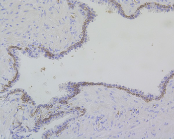 Cytokeratin 17 Recombinant Rabbit Monoclonal Antibody