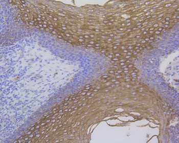 Cytokeratin 17 Recombinant Rabbit Monoclonal Antibody