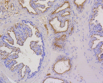 Cytokeratin 17 Recombinant Rabbit Monoclonal Antibody