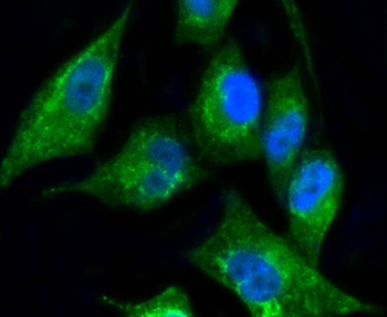 Cytokeratin 17 Recombinant Rabbit Monoclonal Antibody