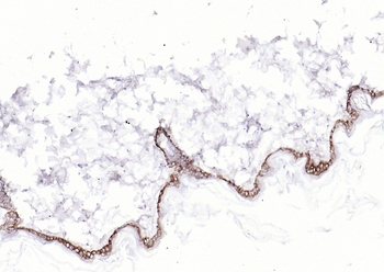 Cytokeratin 14 Recombinant Rabbit Monoclonal Antibody