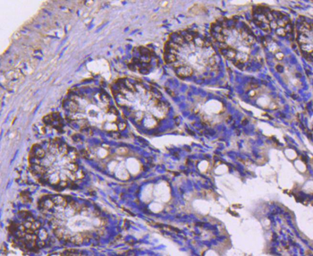 Cyclin B2 Recombinant Rabbit Monoclonal Antibody