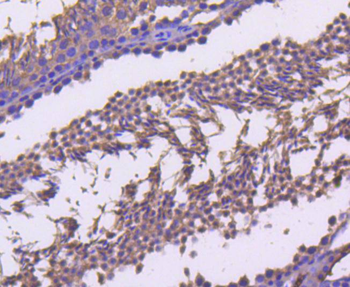 Cyclin B2 Recombinant Rabbit Monoclonal Antibody