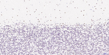 Phospho-H2AX (Ser139) Recombinant Rabbit Monoclonal Antibody