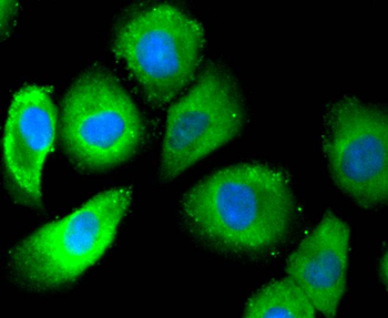 Phospho-Estrogen Receptor alpha (Ser118) Recombinant Rabbit Monoclonal Antibody
