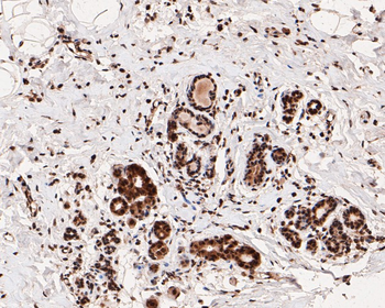 Phospho-Estrogen Receptor alpha (Ser118) Recombinant Rabbit Monoclonal Antibody