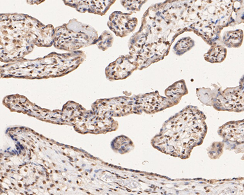 Phospho-Estrogen Receptor alpha (Ser118) Recombinant Rabbit Monoclonal Antibody