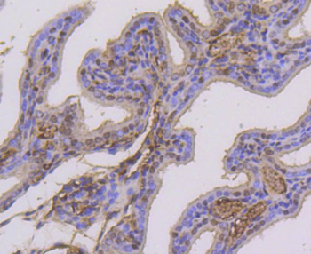 Phospho-Estrogen Receptor alpha (Ser118) Recombinant Rabbit Monoclonal Antibody