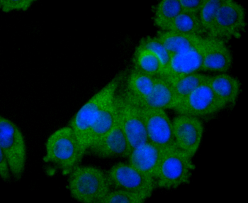 STAT2 Recombinant Rabbit Monoclonal Antibody