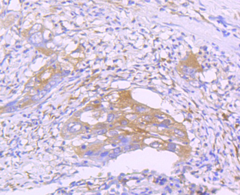 STAT2 Recombinant Rabbit Monoclonal Antibody