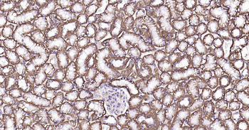 Sodium Potassium ATPase Recombinant Rabbit Monoclonal Antibody