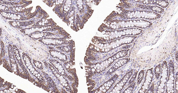 Sodium Potassium ATPase Recombinant Rabbit Monoclonal Antibody