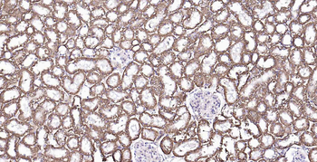 Sodium Potassium ATPase Recombinant Rabbit Monoclonal Antibody