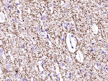 SIRT2 Recombinant Rabbit Monoclonal Antibody