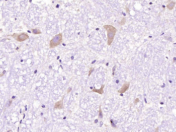 SIRT2 Recombinant Rabbit Monoclonal Antibody