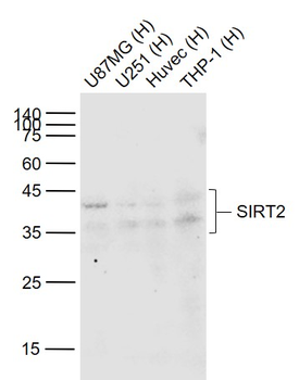 SIRT2 Recombinant Rabbit Monoclonal Antibody