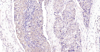 PI3-kinase p110 subunit beta Recombinant Rabbit Monoclonal Antibody