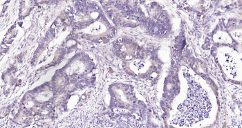 Phospho-YAP1 (Ser127) Recombinant Rabbit Monoclonal Antibody