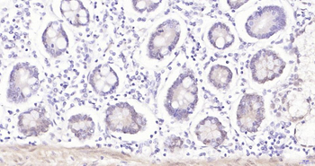 Phospho-YAP1 (Ser127) Recombinant Rabbit Monoclonal Antibody
