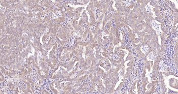 Phospho-YAP1 (Ser127) Recombinant Rabbit Monoclonal Antibody
