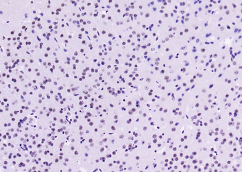 Phospho-STAT1 (Ser727) Recombinant Rabbit Monoclonal Antibody