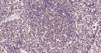 Phospho-JAK2 (Tyr1007+Tyr1008) Recombinant Rabbit Monoclonal Antibody