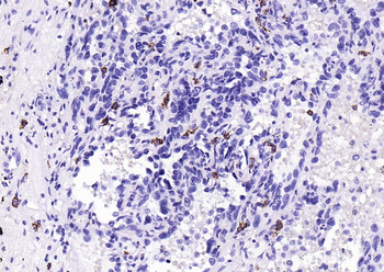 C-Kit Recombinant Rabbit Monoclonal Antibody