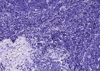 C-Kit Recombinant Rabbit Monoclonal Antibody