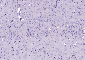 C-Kit Recombinant Rabbit Monoclonal Antibody