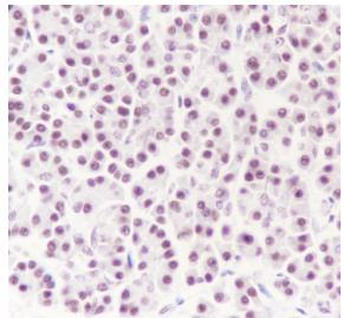 Cdk9 Recombinant Rabbit Monoclonal Antibody