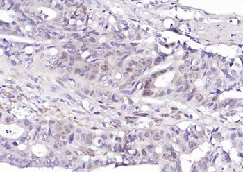 Phospho-HSF1 (Ser326) Recombinant Rabbit Monoclonal Antibody