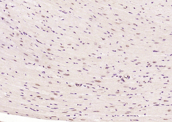 Phospho-HSF1 (Ser326) Recombinant Rabbit Monoclonal Antibody