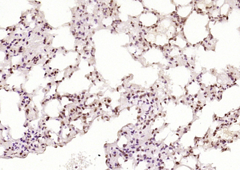 Phospho-HSF1 (Ser326) Recombinant Rabbit Monoclonal Antibody