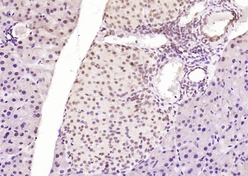 Phospho-HSF1 (Ser326) Recombinant Rabbit Monoclonal Antibody