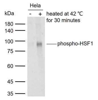 Phospho-HSF1 (Ser326) Recombinant Rabbit Monoclonal Antibody