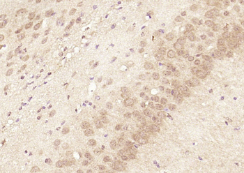 Smooth muscle Myosin heavy chain 11 Rabbit Polyclonal Antibody