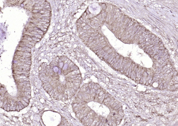 CK14+17+42+10 Rabbit Polyclonal Antibody