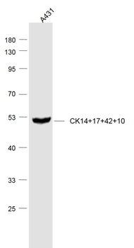 CK14+17+42+10 Rabbit Polyclonal Antibody