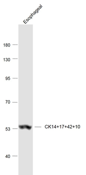 CK14+17+42+10 Rabbit Polyclonal Antibody