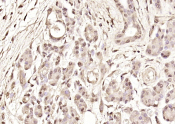 RAR gamma Rabbit Polyclonal Antibody