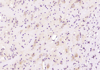 Artemin Rabbit Polyclonal Antibody