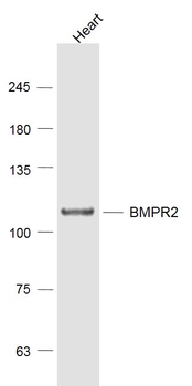BMPR2 Rabbit Polyclonal Antibody