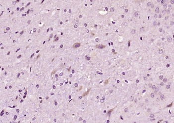 Neurotrophin 3 Rabbit Polyclonal Antibody
