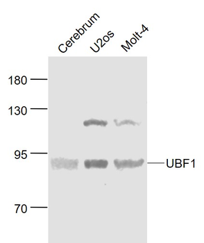 UBF1 Rabbit Polyclonal Antibody