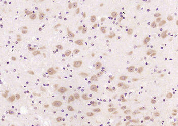 Dab1 Rabbit Polyclonal Antibody